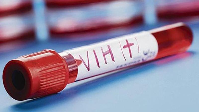 En pandemia no se habrían realizado 27.451 pruebas de diagnóstico del virus VIH.